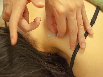 きりん接骨鍼灸院 尼崎武庫之荘店の写真/【だっこ紐で辛い首肩コリ/腰の悩み撃退!】整体×鍼施術で根本から悩み解消♪豊富な知識＆技術で根本改善!