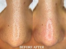 サロン ムスブ(salon MUSUBU)/山梨エステ/甲府エステ