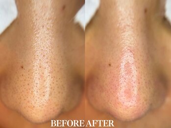 サロン ムスブ(salon MUSUBU)/山梨エステ/甲府エステ