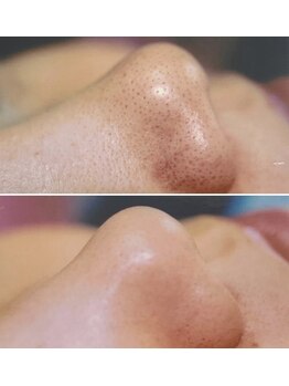 ララ(LALA)/姪浜フェイシャルエステ【姪浜】