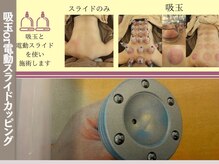 コッペハーブス(Coppe Herbs)の雰囲気（カッピングであなたの疲れを可視化→巡る身体へ　新感覚の電動も）