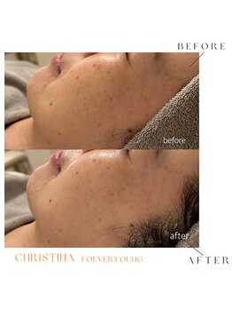 シェア(share.)/フォーエバーヤング