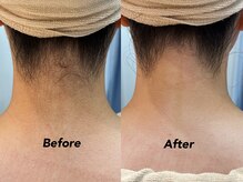 クイーン(QUEEN)/前撮り前もシェービング