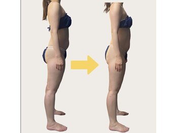 ネオボディ(Neo Body)/ビフォーアフター