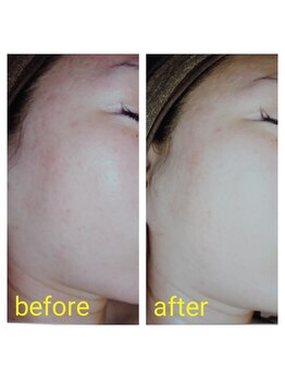 カノン(KANON)/グリーンピール