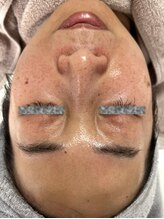 リアスキン(Lia skin)/シミ、毛穴でお悩みの方