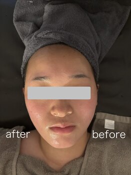 ココ アンジュ(COCO ANGE)/