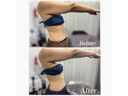 アオレニア(ao.lenia)の写真