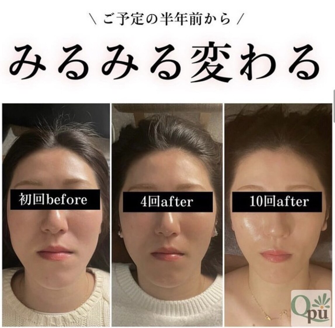 VFアジャスター‼️整体✨美容✨マッサージ✨小顔矯正✨頭蓋矯正 キュープ 名張店(Qpu)｜ホットペッパービューティー