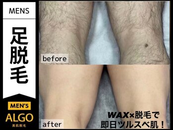 アルゴ 山口宇部店(ALGO)/即日でここまで綺麗に！