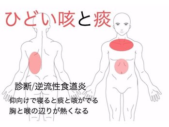 國定鍼灸院/逆流性食道炎の症例