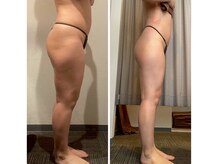 ラサロンホープ 西麻布(La.SALON HOPE)/お尻がギュッ上がる！