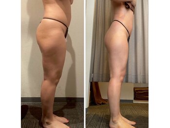 ラサロンホープ 西麻布(La.SALON HOPE)/お尻がギュッ上がる!