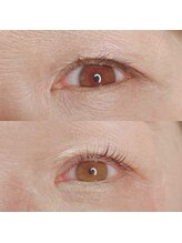 エイミー(eimy)/アディクトカール