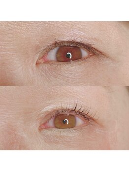 エイミー(eimy)/アディクトカール