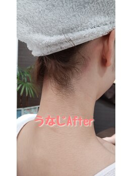 エステシェービングサロン フルール(Fleur)/うなじのアフター