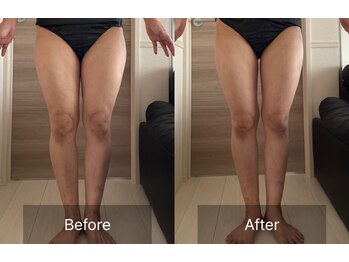 リリーミー(Lily me)/10分のビフォーアフター