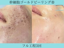 リメイククリニカルビューティー(Remake clinical beauty)/何してもなおらない