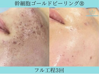 リメイククリニカルビューティー(Remake clinical beauty)/何してもなおらない