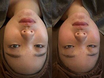 R-1ビューティーサロン 表参道/Before&After