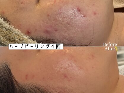ワイシーハッチ(yc.hacci)の写真