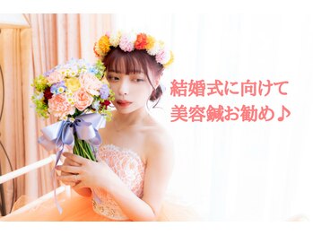 泉町鍼灸整骨院/結婚式に向けて美容鍼お勧め