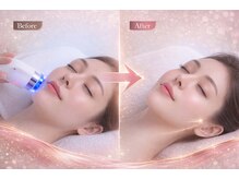 アプロ(Aphro)/1回でも効果を実感