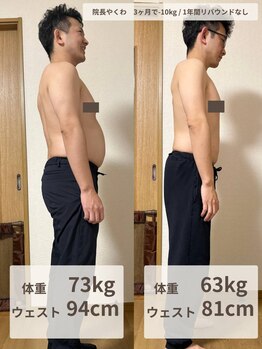 やくわ新坂町はり灸マッサージ治療院/院長ビフォーアフター（右向き）