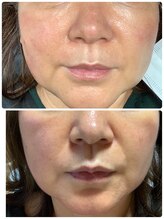 らくらく韓国エステ/フェイシャルメニュー