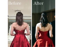 ブライダルエステ ジュエル(JEWEL)/二の腕引き締め・背中美肌ケア