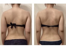 ルシエル ハカタ(Luciel HAKATA)/痩身120分1回の変化(20代) 