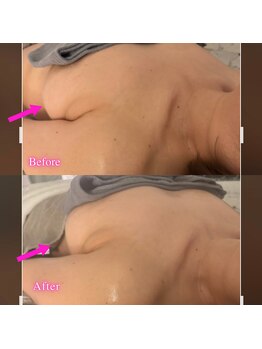 ザ レディービー(The Lady B)/バストケア