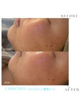 シェア(share.)/艶肌waxとクリスティーナセット