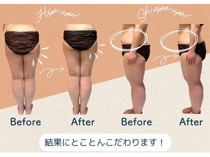 ヨサパーク マシマシ(YOSA PARK mashi-mashi)の写真