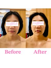 セルフィッシュ(Cellfish)/ブライダルフェイシャル