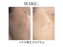 ハク(HAKU)