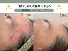 ヴィキ 北千住(VIKI)
