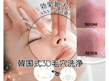 ピエナ(Piena)/韓国式3D毛穴洗浄