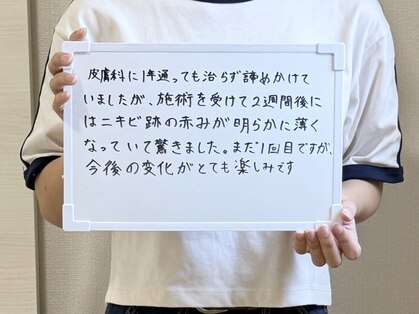 シェノン 赤坂大濠店の写真