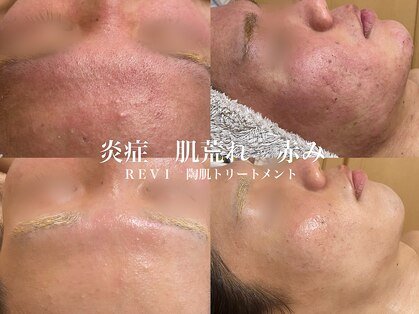ラクシュミー ナチュラル(Laksmy NATURAL)の写真