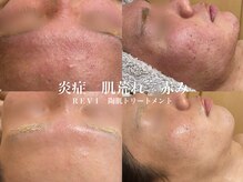 ラクシュミー ナチュラル(Laksmy NATURAL)