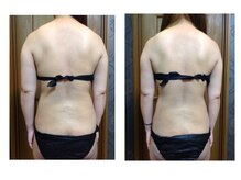 健康センター トロイカ/ブライダルエステ！20代、10回