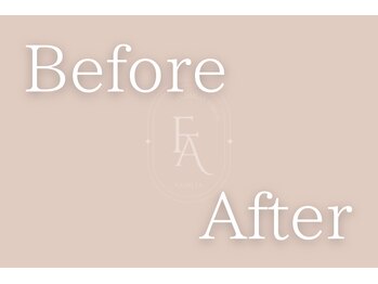 ファミーユ 名古屋店/【before after】インディバ効果