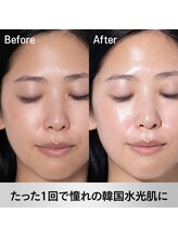 エミレーブ シロカネ(Hemireve Shirokane)/ハンド施術による細部ケア