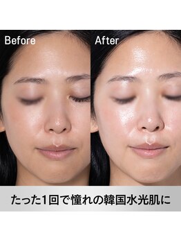 エミレーブ シロカネ(Hemireve Shirokane)/ハンド施術による細部ケア