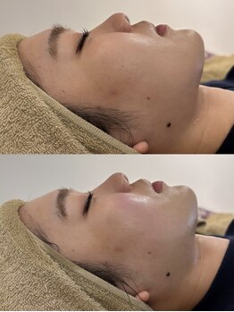 マホロバ セカンド(mahoroba 2nd)/ララピールよもぎ蒸し