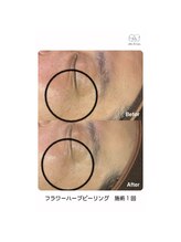 サロンドビジュー(salon de bijou)/フラワーハーブピーリング×艶肌