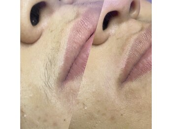 サロンミー(salon Mii)/