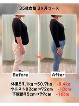 くさば整骨院/35歳女性/ダイエット3か月コース