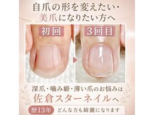 スターネイル(Starnail)